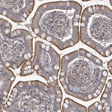 Anti-TRIM60 antibody produced in rabbit Prestige Antibodies&#174; Powered by Atlas Antibodies, affinity isolated antibody, buffered aqueous glycerol solution