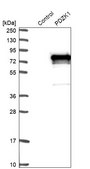 Anti-PDZK1 antibody produced in rabbit Prestige Antibodies&#174; Powered by Atlas Antibodies, affinity isolated antibody, buffered aqueous glycerol solution, Ab1