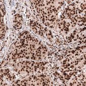 Monoclonal Anti-Bcor Antibody Produced In Mouse Prestige Antibodies&#174; Powered by Atlas Antibodies, clone CL13841, affinity isolated antibody, buffered aqueous glycerol solution