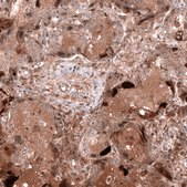 Anti-WFDC2 antibody produced in mouse Prestige Antibodies&#174; Powered by Atlas Antibodies, clone CL12917, purified by using Protein A, buffered aqueous glycerol solution
