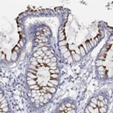 Anti-KCNA1 antibody produced in rabbit Prestige Antibodies&#174; Powered by Atlas Antibodies, affinity isolated antibody, buffered aqueous glycerol solution
