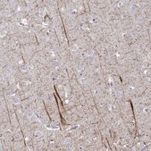Anti-NEFL antibody produced in rabbit Prestige Antibodies&#174; Powered by Atlas Antibodies, affinity isolated antibody, buffered aqueous glycerol solution