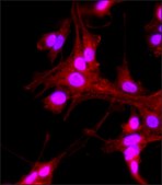 Anti-VAChT (C-terminal) antibody produced in rabbit IgG fraction of antiserum