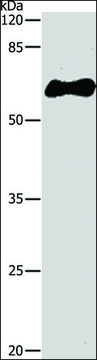 Anti-GST Tag antibody produced in rabbit affinity isolated antibody