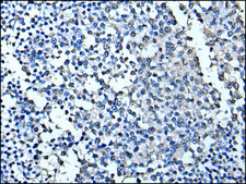 Anti-TIA1 affinity isolated antibody