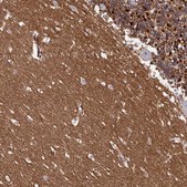 Anti-FXYD6 antibody produced in rabbit Prestige Antibodies&#174; Powered by Atlas Antibodies, affinity isolated antibody, buffered aqueous glycerol solution