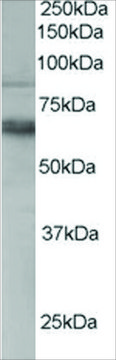 Anti-TEM8/Anthrax Toxin Receptor 1 antibody produced in goat affinity isolated antibody, buffered aqueous solution