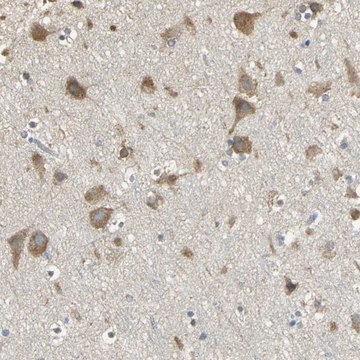 Anti-ACSL4 antibody produced in rabbit Prestige Antibodies&#174; Powered by Atlas Antibodies, affinity isolated antibody, buffered aqueous glycerol solution