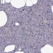Anti-CDK5 antibody produced in rabbit Prestige Antibodies&#174; Powered by Atlas Antibodies, affinity isolated antibody