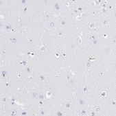 Anti-FGB antibody produced in rabbit Ab2, Prestige Antibodies&#174; Powered by Atlas Antibodies, affinity isolated antibody, buffered aqueous glycerol solution