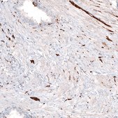 Monoclonal Anti-TUBB3 antibody produced in mouse Prestige Antibodies&#174; Powered by Atlas Antibodies, clone CL5814, purified immunoglobulin, buffered aqueous glycerol solution
