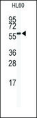 Anti-SENP2 (C-term) antibody produced in rabbit IgG fraction of antiserum, buffered aqueous solution