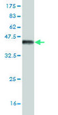 Monoclonal Anti-CACNB1 antibody produced in mouse clone 1G6, purified immunoglobulin, buffered aqueous solution