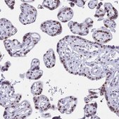 Anti-KLF14 antibody produced in rabbit Prestige Antibodies&#174; Powered by Atlas Antibodies, affinity isolated antibody, buffered aqueous glycerol solution