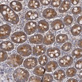 Anti-LTV1 antibody produced in rabbit Prestige Antibodies&#174; Powered by Atlas Antibodies, affinity isolated antibody, buffered aqueous glycerol solution, ab3