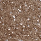 Anti-SLC4A10 antibody produced in rabbit Prestige Antibodies&#174; Powered by Atlas Antibodies, affinity isolated antibody, buffered aqueous glycerol solution