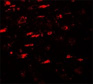 Anti-ULK4 antibody produced in rabbit affinity isolated antibody