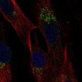 Anti-CCL2 antibody produced in rabbit Prestige Antibodies&#174; Powered by Atlas Antibodies, affinity isolated antibody, buffered aqueous glycerol solution