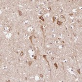 Anti-SLC29A3 antibody produced in rabbit Prestige Antibodies&#174; Powered by Atlas Antibodies, affinity isolated antibody, buffered aqueous glycerol solution