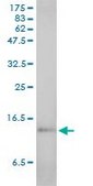 Monoclonal Anti-SAA1 antibody produced in mouse clone 3C11-2C1, purified immunoglobulin, buffered aqueous solution
