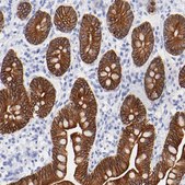 Anti-KRT19 antibody produced in rabbit Prestige Antibodies&#174; Powered by Atlas Antibodies, affinity isolated antibody, buffered aqueous glycerol solution