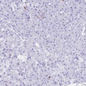 Anti-CORO1A antibody produced in rabbit Prestige Antibodies&#174; Powered by Atlas Antibodies, affinity isolated antibody, buffered aqueous glycerol solution