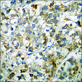 Anti-phospho-PKR (pThr446) antibody produced in rabbit affinity isolated antibody