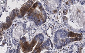 Anti-p-RPS6 (Ser240/244) Antibody, clone 2H10 ZooMAb&#174; Rabbit Monoclonal recombinant, expressed in HEK 293 cells