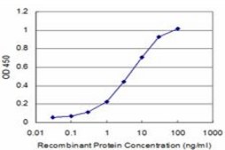 Monoclonal Anti-PRL, (C-terminal) antibody produced in mouse clone 1E1, purified immunoglobulin, buffered aqueous solution