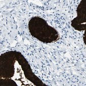 Anti-MUC5B antibody produced in rabbit Prestige Antibodies&#174; Powered by Atlas Antibodies, affinity isolated antibody, buffered aqueous glycerol solution