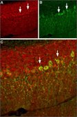 Anti-Sodium Channel, Pan antibody produced in rabbit affinity isolated antibody, lyophilized powder