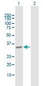 Anti-PYCR1 antibody produced in mouse purified immunoglobulin, buffered aqueous solution