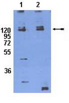 Anti-phospho-Integrin &#946;1 (Thr788/789) Antibody serum, Chemicon&#174;