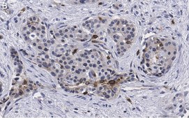 Anti-Cyclin D1 Antibody, clone 1J9, ZooMAb&#174; Rabbit Monoclonal recombinant, expressed in HEK 293 cells