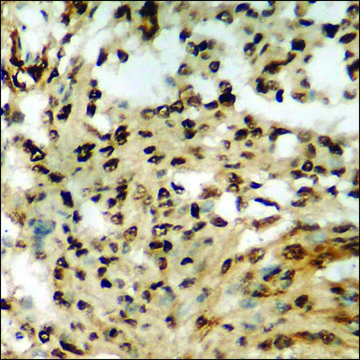 Anti-phospho-Retinoblastoma (pSer807) antibody produced in rabbit affinity isolated antibody