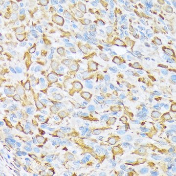 Anti-Sec23A antibody produced in rabbit