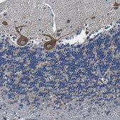 Anti-SLC25A25 antibody produced in rabbit Prestige Antibodies&#174; Powered by Atlas Antibodies, affinity isolated antibody, buffered aqueous glycerol solution