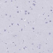 Anti-CD7 antibody produced in rabbit Prestige Antibodies&#174; Powered by Atlas Antibodies, affinity isolated antibody, buffered aqueous glycerol solution