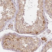 Monoclonal Anti-RHOT1 antibody produced in mouse Prestige Antibodies&#174; Powered by Atlas Antibodies, clone CL1083, purified immunoglobulin, buffered aqueous glycerol solution