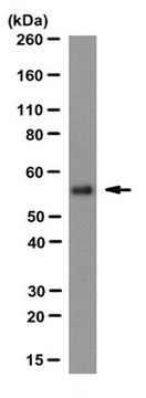 Anti-ATP Synthase subunit &#946; Antibody, clone 11/21-7-A8 clone 11/21-7-A8, from mouse