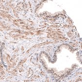 Anti-SMC6 antibody produced in rabbit Prestige Antibodies&#174; Powered by Atlas Antibodies, affinity isolated antibody, buffered aqueous glycerol solution