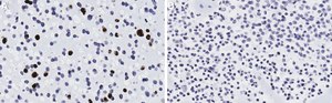 Anti-Adenovirus Antibody, clone 20/11 ZooMAb&#174; Mouse Monoclonal recombinant, expressed in HEK 293 cells