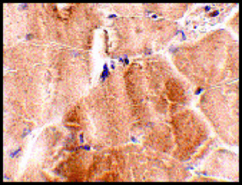 Anti-JPH2 (ab2) antibody produced in rabbit affinity isolated antibody, buffered aqueous solution