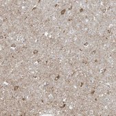Anti-FNDC1 antibody produced in rabbit Prestige Antibodies&#174; Powered by Atlas Antibodies, affinity isolated antibody, buffered aqueous glycerol solution