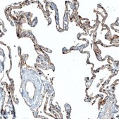 Monoclonal Anti-CD47 antibody produced in mouse Prestige Antibodies&#174; Powered by Atlas Antibodies, clone CL6913, purified immunoglobulin, buffered aqueous glycerol solution