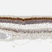 Anti-IMPG2 antibody produced in rabbit Prestige Antibodies&#174; Powered by Atlas Antibodies, affinity isolated antibody