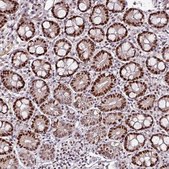 Anti-KLF16 antibody produced in rabbit Prestige Antibodies&#174; Powered by Atlas Antibodies, affinity isolated antibody, buffered aqueous glycerol solution