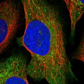 Anti-SDS antibody produced in rabbit Prestige Antibodies&#174; Powered by Atlas Antibodies, affinity isolated antibody, buffered aqueous glycerol solution