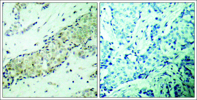 Anti-HDAC5 (Ab-498) antibody produced in rabbit affinity isolated antibody