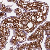 Anti-COL6A2 antibody produced in rabbit Prestige Antibodies&#174; Powered by Atlas Antibodies, affinity isolated antibody